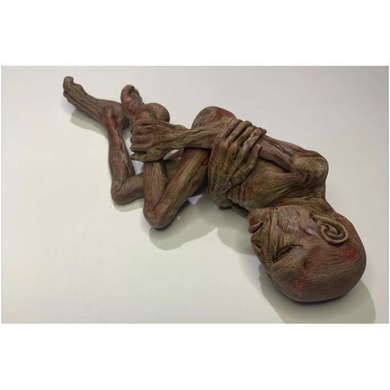 Lord Voldemort (foetus )