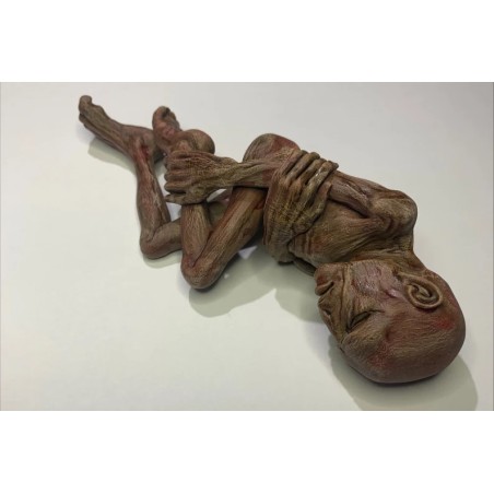 Lord Voldemort (foetus )