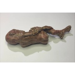 Lord Voldemort (foetus )