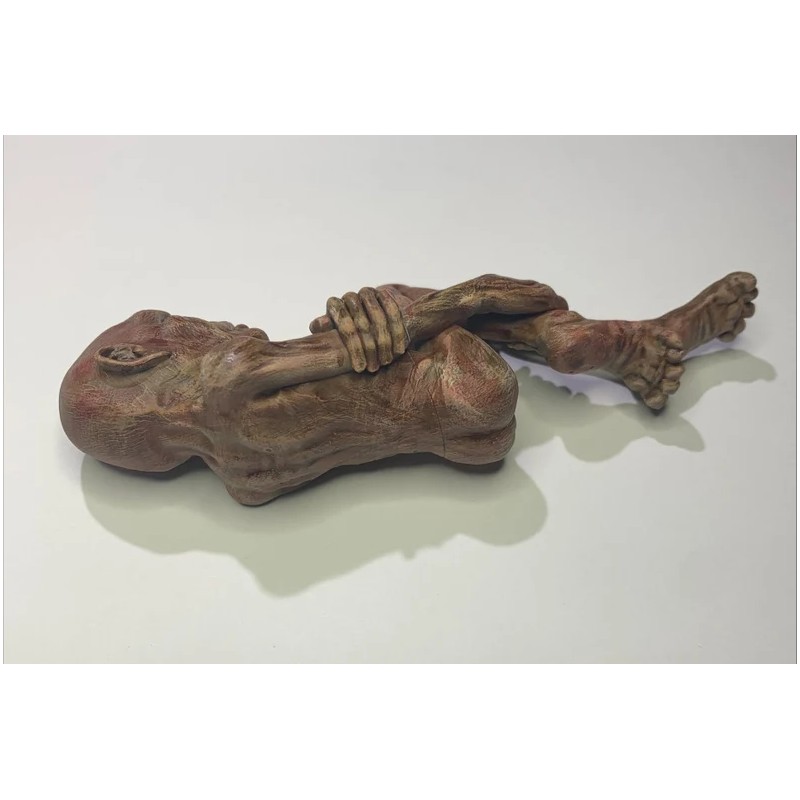 Lord Voldemort (foetus )